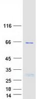 Human TBC1D3C Protein (Recombinant Myc-DDK (Flag))