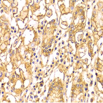IHC-plus™ Basigin / Emmprin / CD147 Antibody