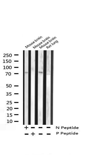 FOXO1 / FKHR Antibody (phospho-Thr24,pThr32)