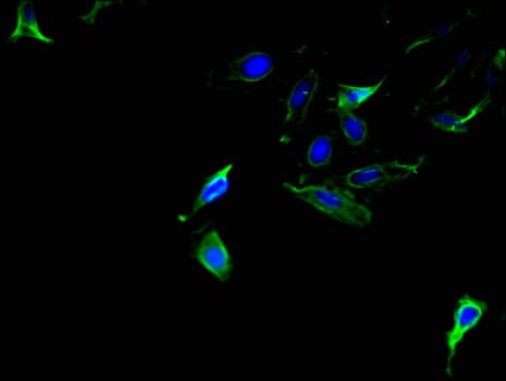 Polyclonal Rabbit anti-Human AMACR / P504S Antibody (IF, WB)
