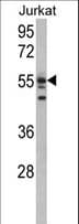 USP22 Antibody (aa1-30)