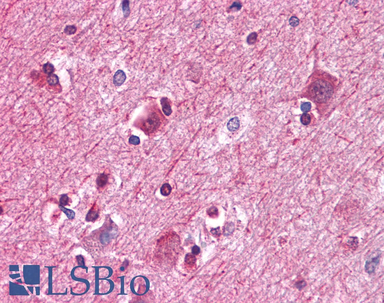 IHC-plus™ Monoclonal Mouse anti-Human PAWR / PAR4 Antibody (clone 3G9H7, IHC, WB)