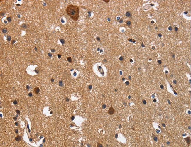 CD27 Antibody