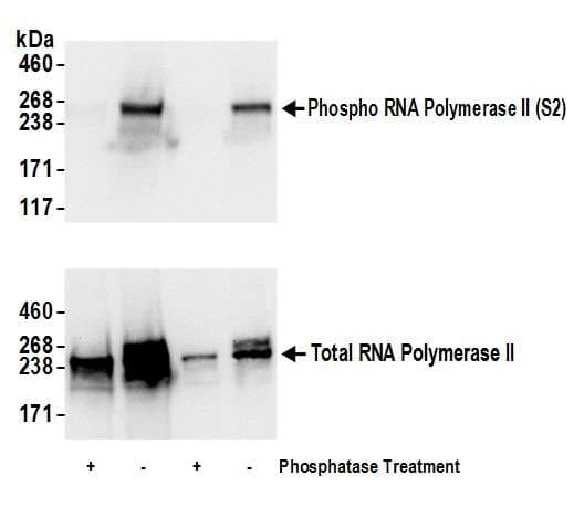 POLR2A / RNA polymerase II Antibody (phospho-Ser2)