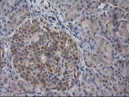 MAPRE2 / EB2 Antibody (clone OTI1D10)