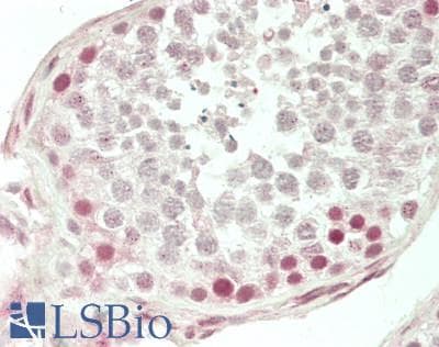 IHC-plus™ Capicua / CIC Antibody (aa1548-1608)