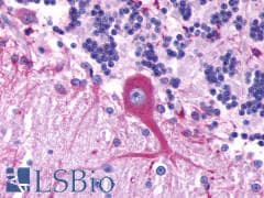 PathPlus™ GPR39 Antibody (Extracellular Domain)
