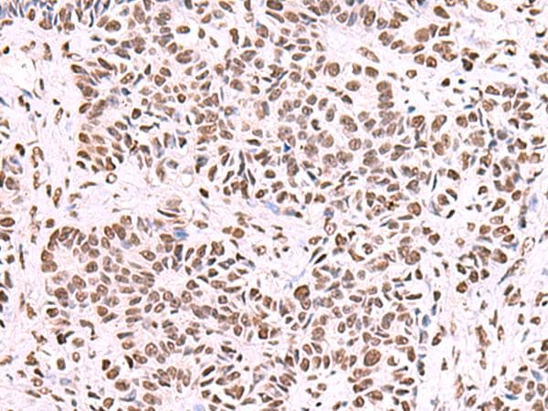 Polyclonal Rabbit anti-Human NASP Antibody (IHC, WB)