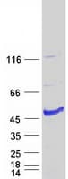 Human AIPL1 Protein (Recombinant Myc-DDK (Flag))