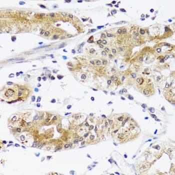 NPPA / ANP Antibody
