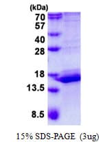 Human CALML3 Protein (Recombinant His)