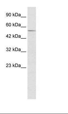 Polyclonal Rabbit anti-Human ZFP91 Antibody (FITC, aa231-280, WB)