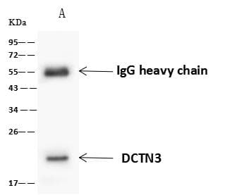 Dynactin 3 / DCTN3 Antibody