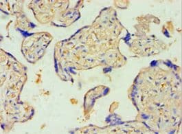 SULT2B1 / Sulfotransferase 2B1 Antibody (aa1-365)