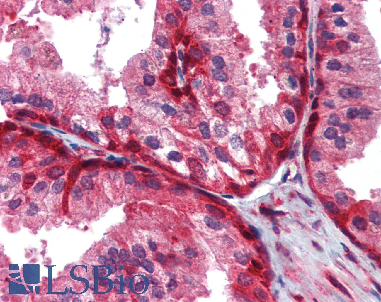 IHC-plus™ WNT5A Antibody (clone 6F2)