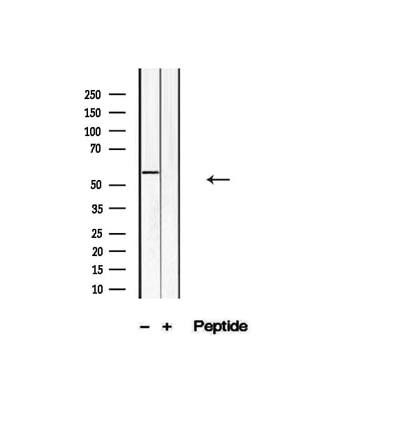 Polyclonal Rabbit anti-Human KLF4 Antibody (IHC, WB)