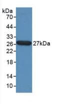 TPT1 / TCTP Antibody (aa1-172)