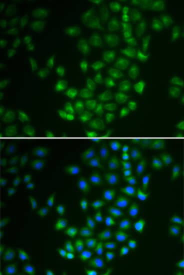 Polyclonal Rabbit anti-Human PRKACB Antibody (IHC, IF, WB)
