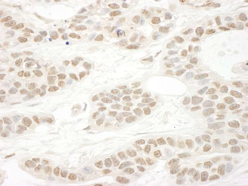 SRSF10 / FUSIP1 Antibody (aa133-183)