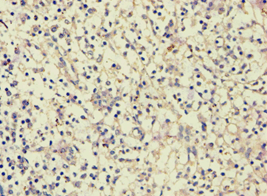 VG5Q / AGGF1 Antibody (aa1-70)