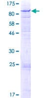 Human GLB1L Protein (Recombinant GST)