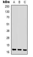 CKLF Antibody (C-Terminus)