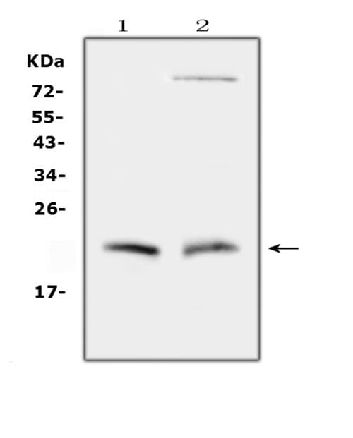 CYGB / Cytoglobin Antibody