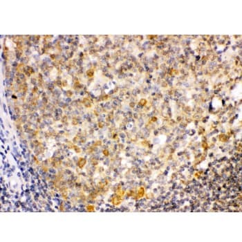 TRIB2 Antibody (aa175-211)