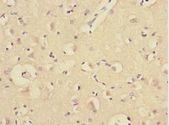 TRIM69 / Trif Antibody