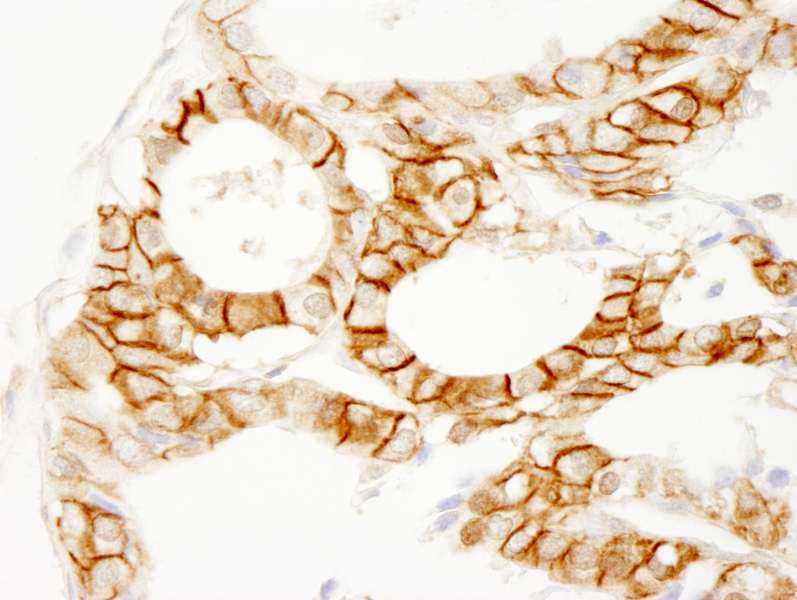 CTNNB1 / Beta Catenin Antibody (aa25-75)
