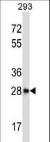 CTDSP2 Antibody (aa11-39)