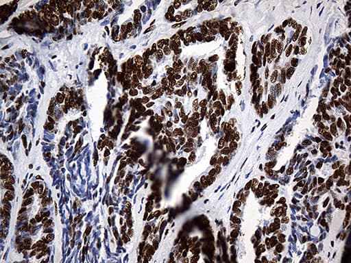 HNRNPH1 / hnRNP H Antibody (clone OTI5D11)