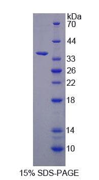 Human GCS1 / MOGS Protein (Recombinant His-T7, N-terminus)