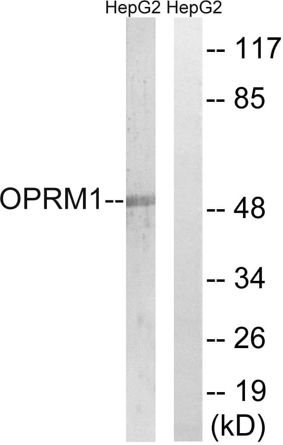 OPRM1 / Mu Opioid Receptor Antibody (aa21-70)