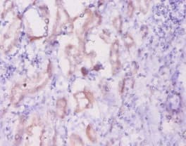 INHA / Inhibin Alpha Antibody