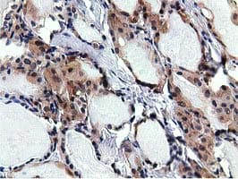 RBBP9 Antibody (clone OTI4G3)