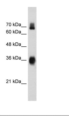 KEAP1 Antibody (aa543-592)