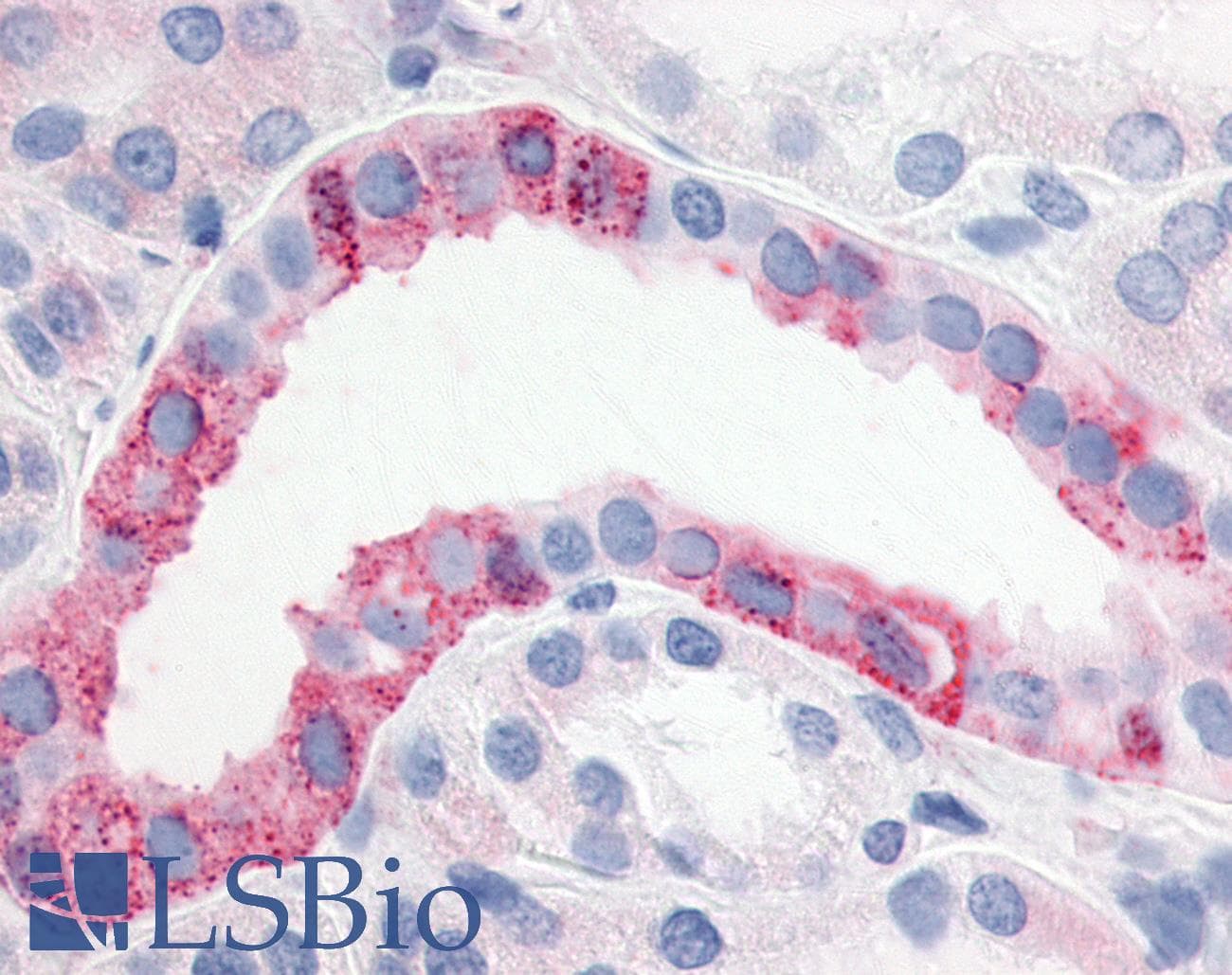 PathPlus™ Polyclonal Rabbit anti-Human ESRRG / ERR Gamma Antibody (N-Terminus, IHC)
