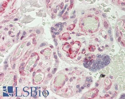 Polyclonal Rabbit anti-Human RAPGEF1 Antibody (aa866-915, IHC, WB)