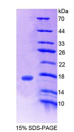 Human CHRNB3 Protein (Recombinant His-T7)