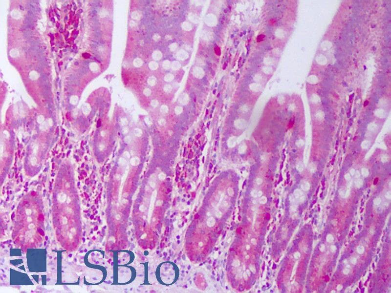 IHC-plus™ IFNL2 / IL28A Antibody