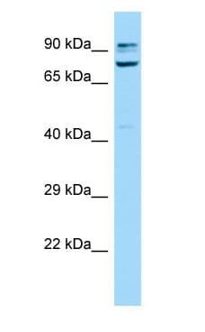 SORBS1 / Ponsin Antibody (aa861-910)