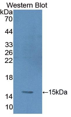 GYPA / CD235a / Glycophorin A Antibody (aa20-91, FITC)