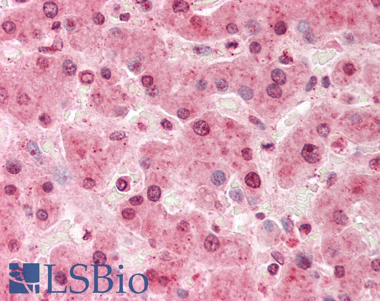 SORD / Sorbitol Dehydrogenase Antibody (aa72-121)