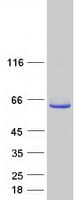 Human TRMO / C9orf156 Protein (Recombinant Myc-DDK (Flag))