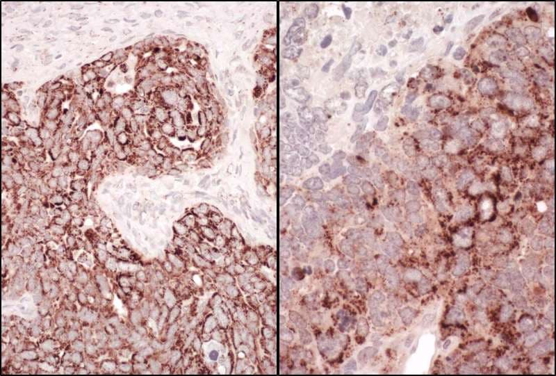 HSPD1 / HSP60 Antibody (aa50-100)