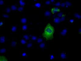 LIPG / Endothelial Lipase Antibody (clone OTI3C7)