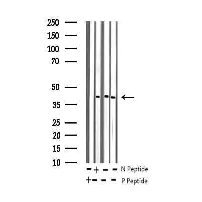 JUNB / JUN-B Antibody (phospho-Ser259)