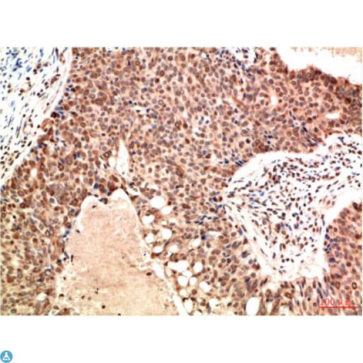ATM Antibody