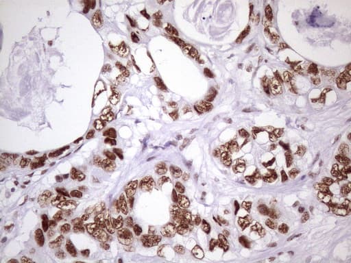 NUDT21 Antibody (aa2-227, clone OTI1B1)